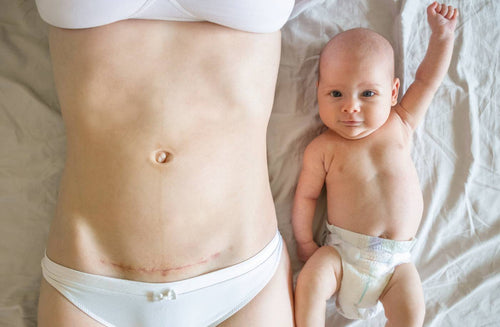 9 C-Section Recovery Tips to Help Your Body Heal