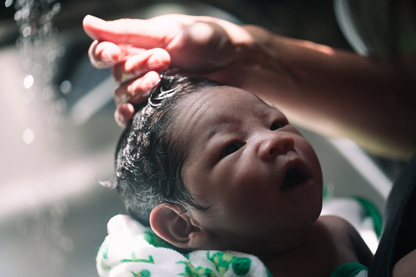 Coconut Oil dandruff and dry, Itchy scalp - Best for Diaper Rash