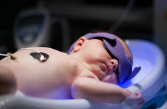 Jaundice in Newborns: Everything You Need to Know