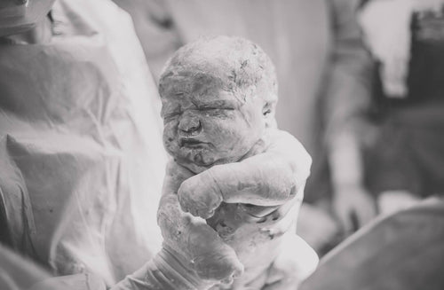 Vernix: Rub It in or Wash It Off?