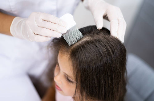 What Parents Need to Know About Head Lice