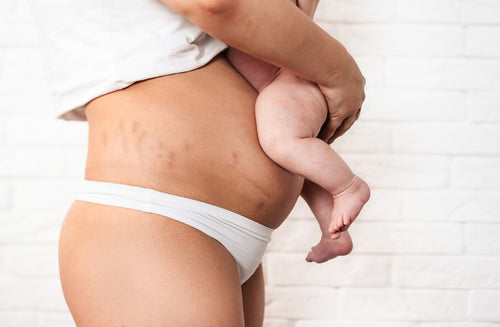 5 Weird Things That Happen to Your Body After Birth