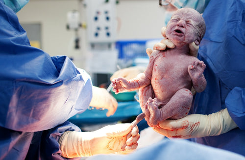 What Happens During a C-Section?